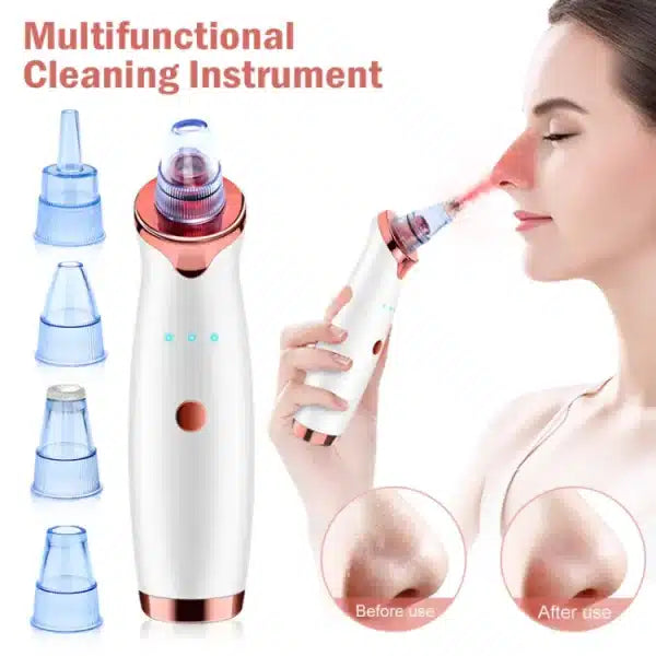 Buy Vacuum Blackhead Remover – Electric Pore Cleaner & Pimple Removal Machine