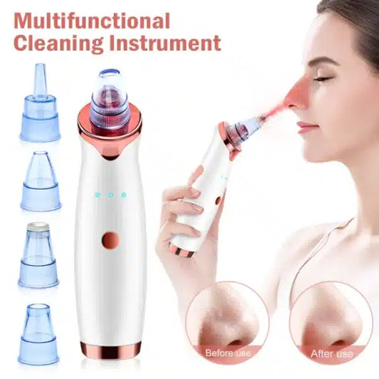 Buy Vacuum Blackhead Remover – Electric Pore Cleaner & Pimple Removal Machine